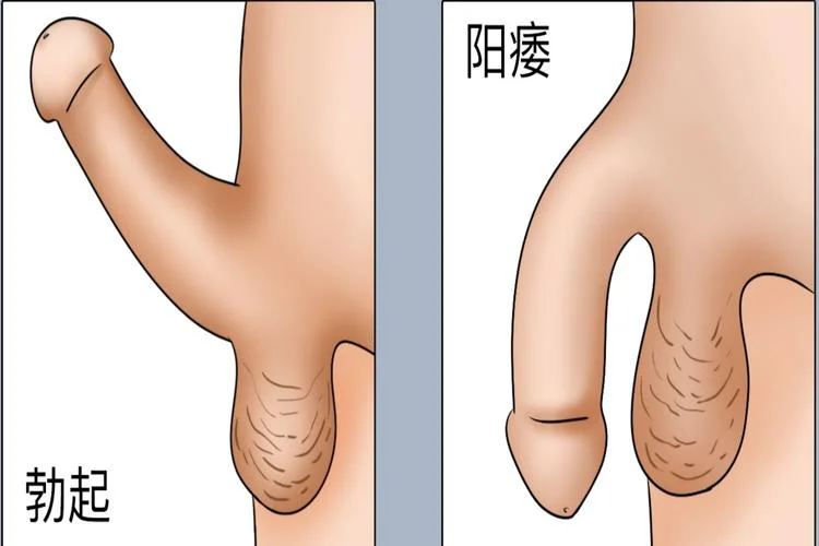 阳痿原理_1