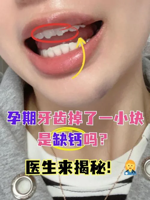 梦见后面大牙掉渣_1
