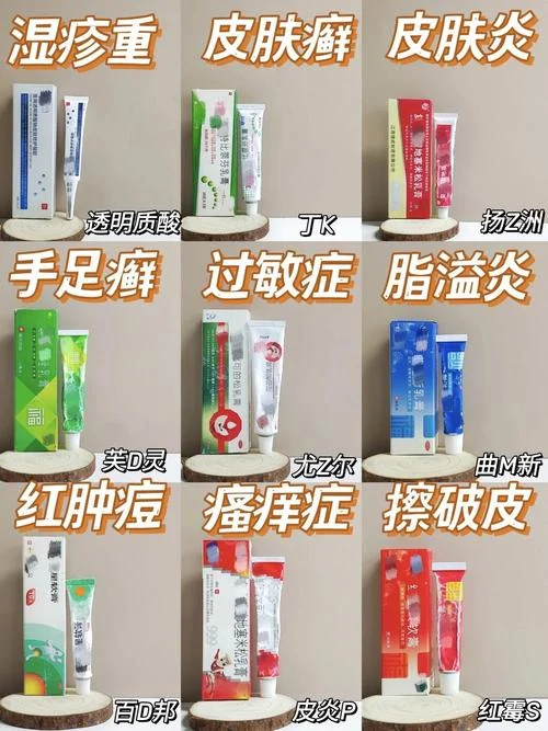 治疗湿疹药膏叫什么_1