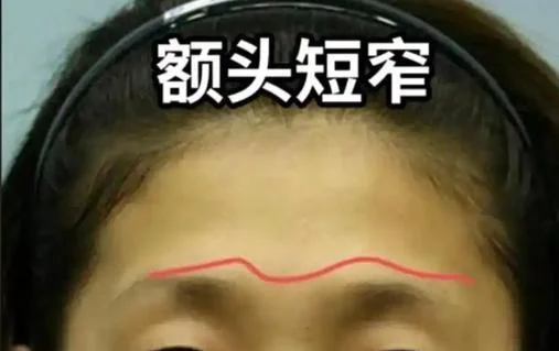 男人额头低窄面相_1