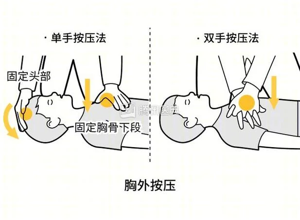 抢救按压心脏叫什么_2
