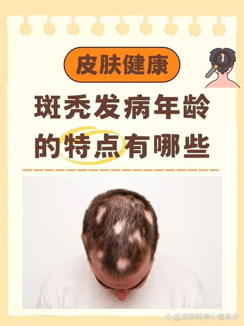 老人脱发是缺什么_1