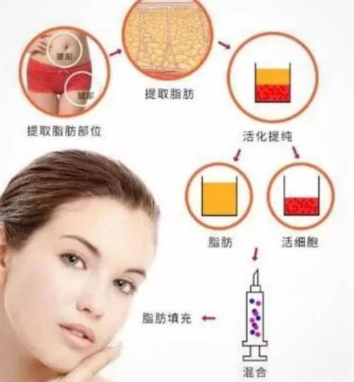 填充是什么意思_2