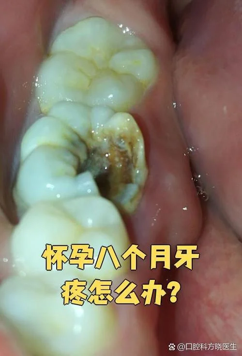 孕妇做梦牙疼牙齿松动-孕妇梦牙疼齿松