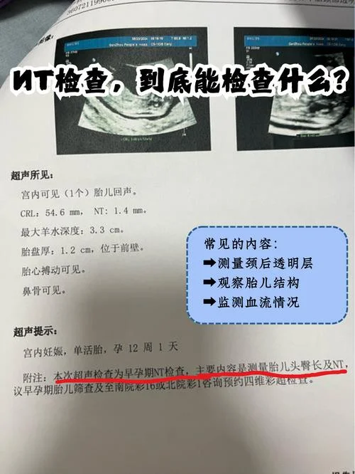 胎儿做nt是检查什么_1