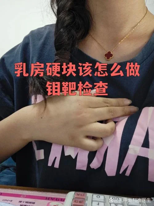 什么是钼靶检查_2