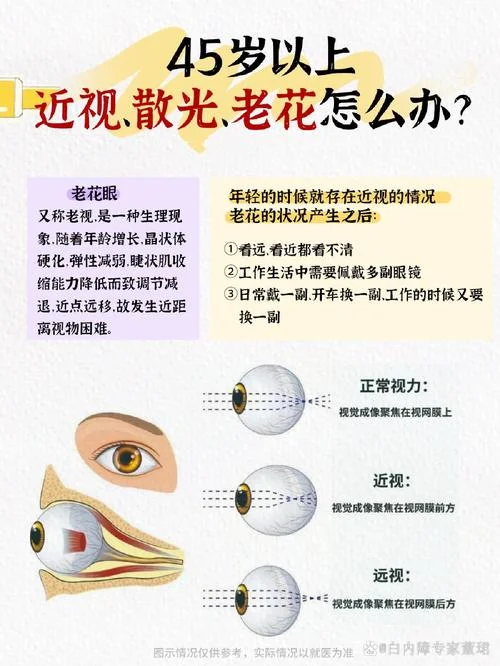 眼睛老花什么症状是_1