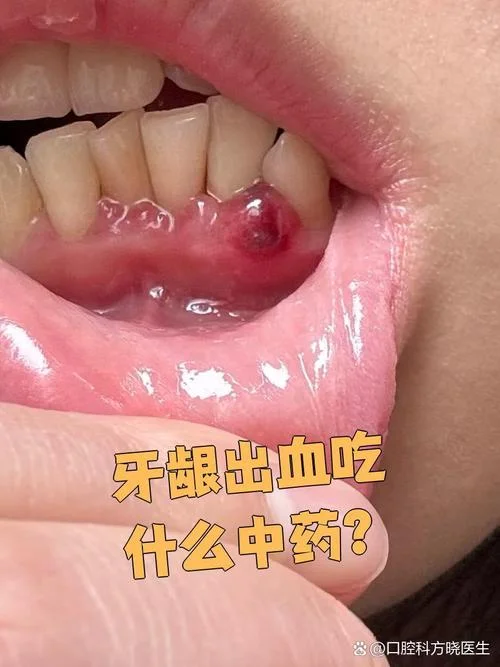 梦见牙痛掉牙流血_2