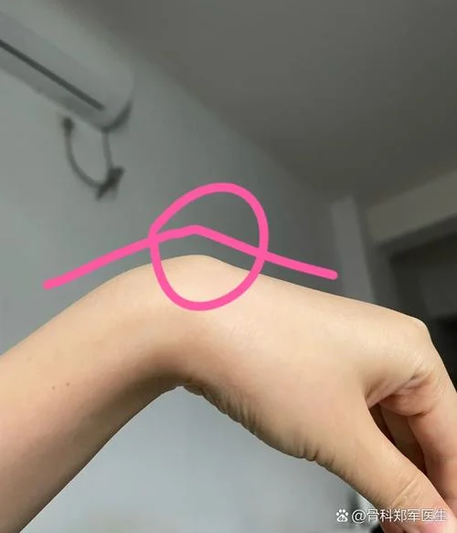 左手手腕骨头突出处疼_2