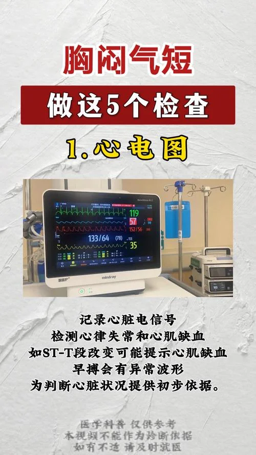 心肌缺血如何查-心肌缺血查方法