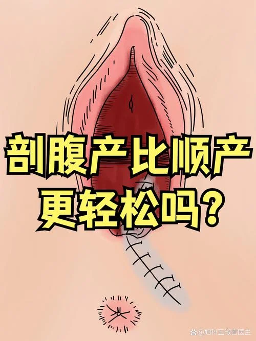 剖腹产历史追溯_1