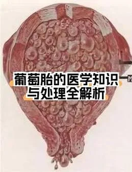 葡萄胎又叫什么_1
