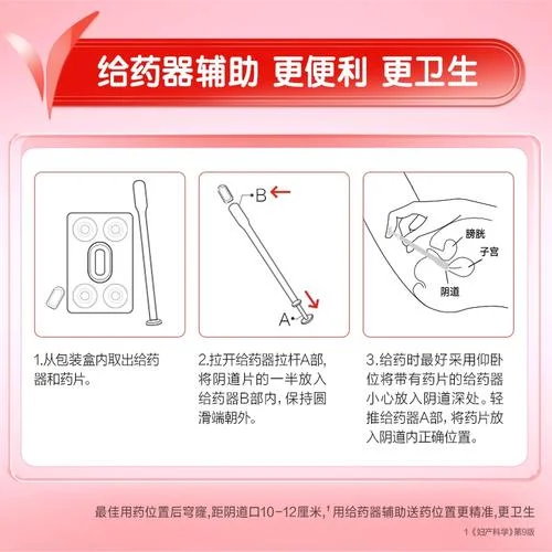 克霉唑怎么用-克霉唑外用用法