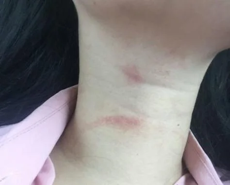 梦见别人在我脖子上吸吻痕_1