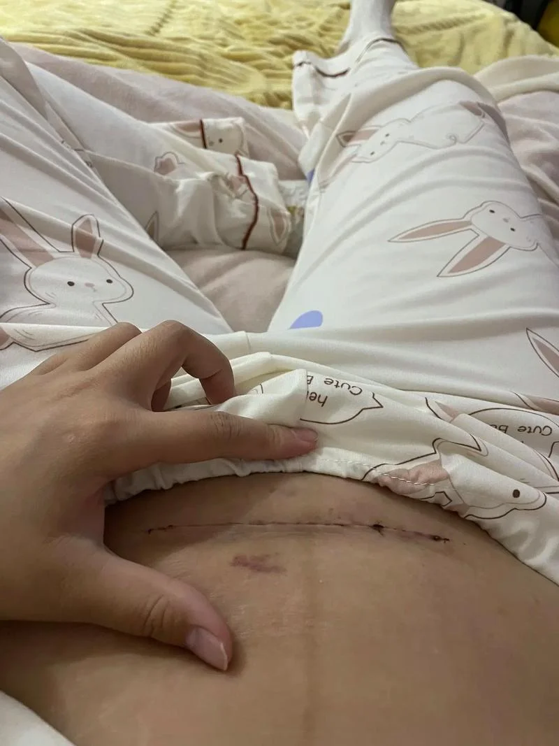剖腹产38天做梦高潮_2