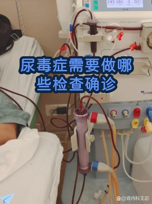 如何查尿毒症-查尿毒症诊断