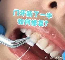梦见门牙断一半了-梦门牙断半