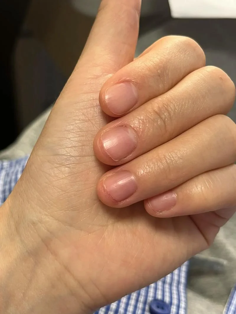已婚女人梦见自己剪指甲-已婚女性梦见剪指甲
