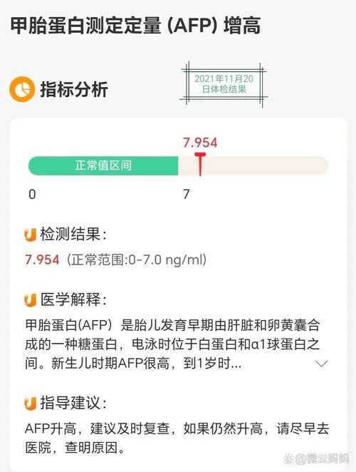 甲胎蛋白是检查什么_1