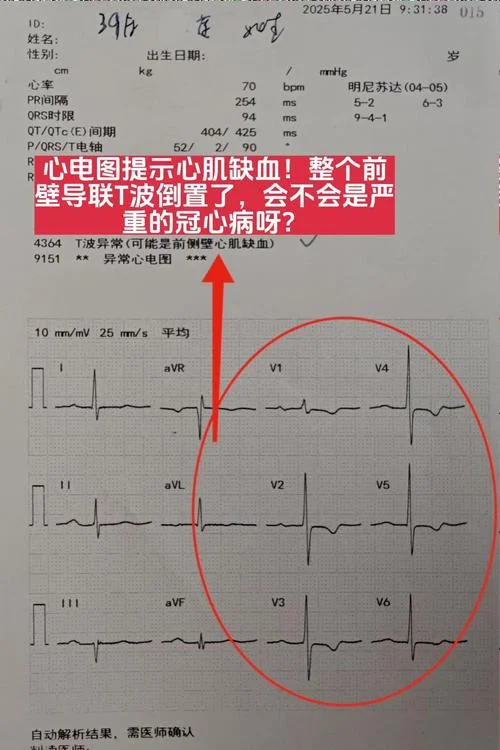 心肌5项是检查什么_1