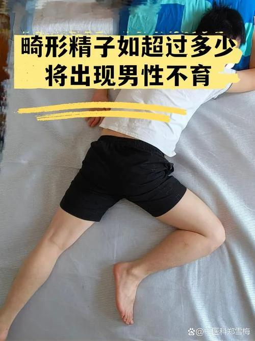 什么是精子畸形率_2