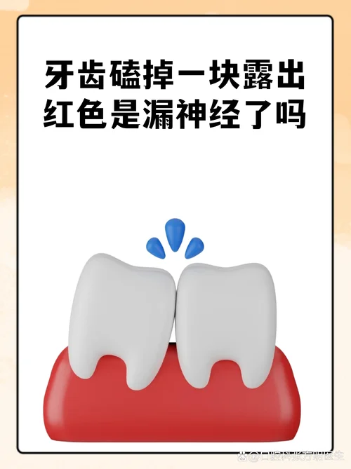 梦见牙被磕掉了一嘴_1