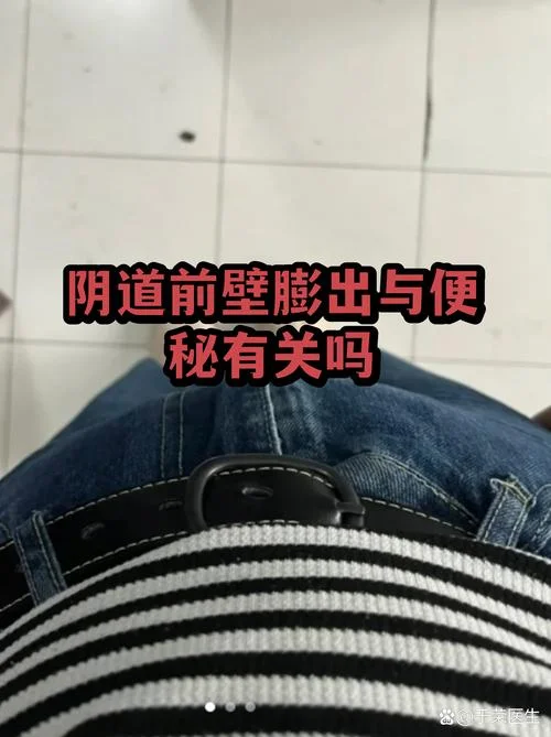 阴壁膨出自己能好吗_1