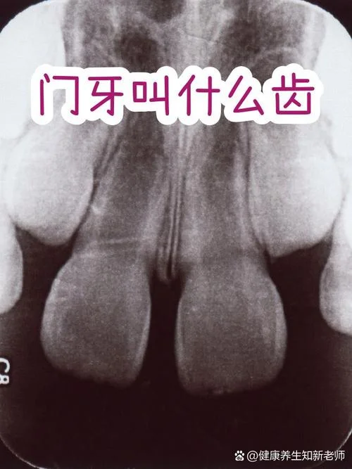 牙齿都叫什么_1