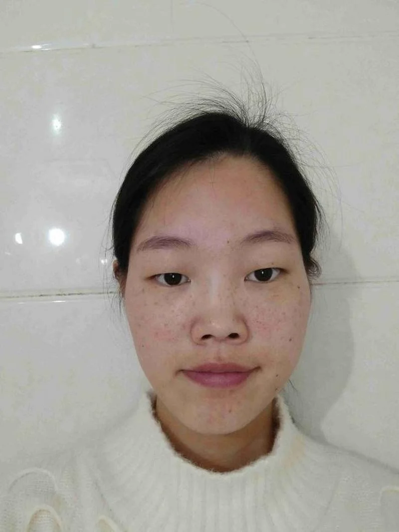 额头窄小的女人面相_2