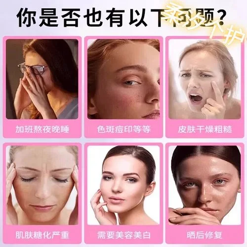 妥塞敏治疗黄褐斑原理_1