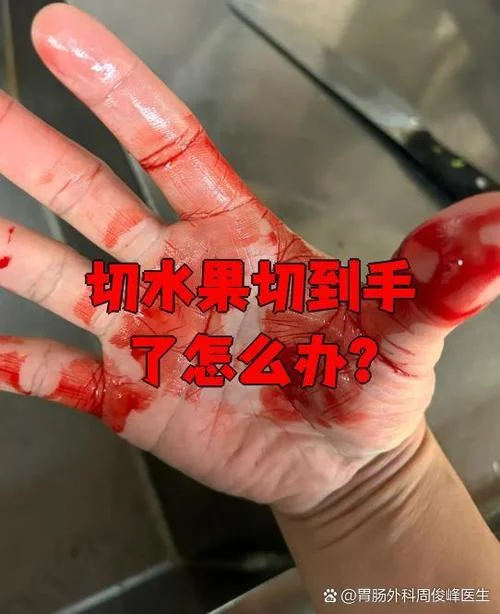 梦见切肉把自己手切了-梦见切肉伤手