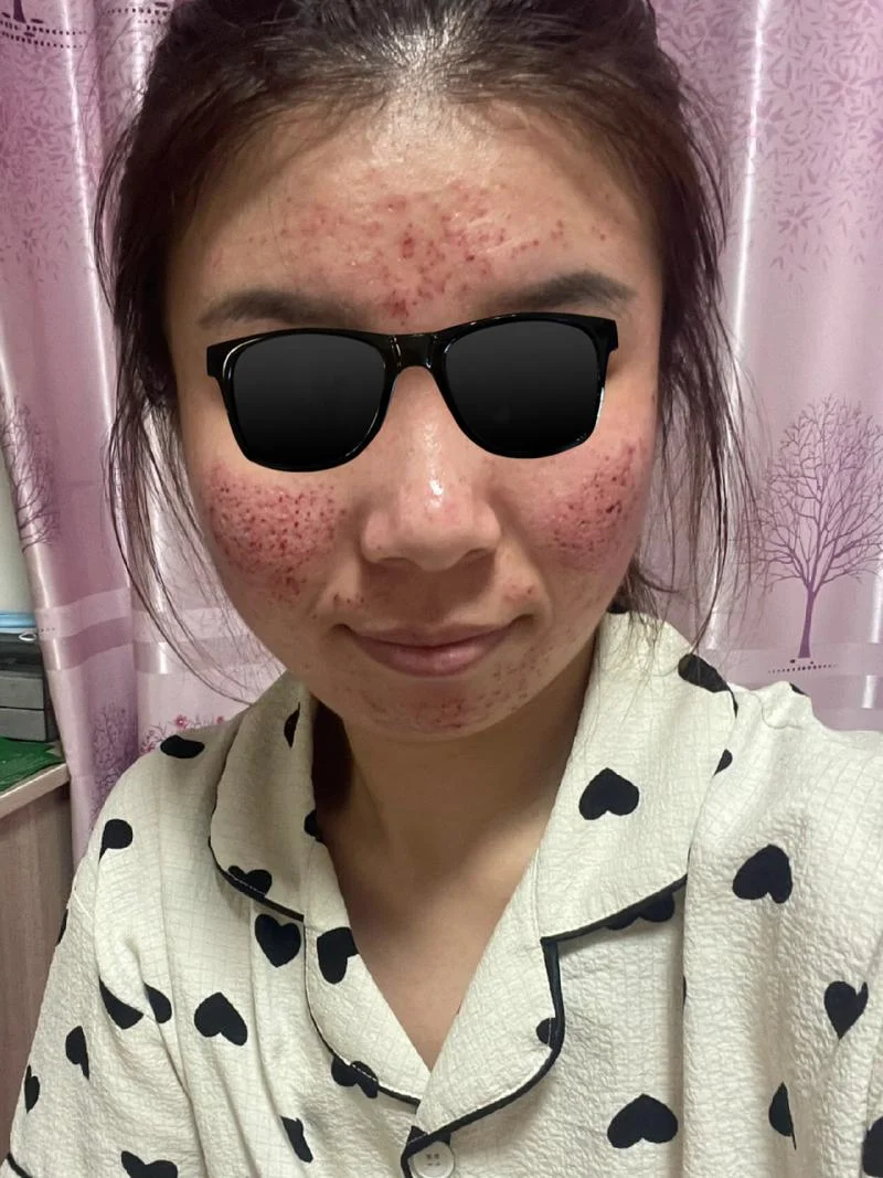 梦见自己的脸烂了_2