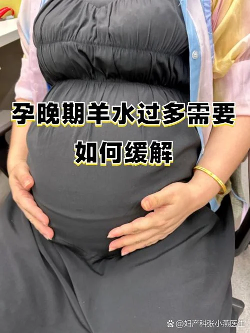 孕妇梦见水是男孩女孩-孕妇梦见水知男女