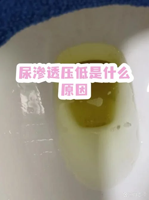 尿渗透压在哪个项目里面查_2