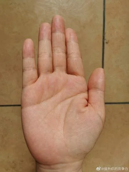 手相密密麻麻的细纹_1