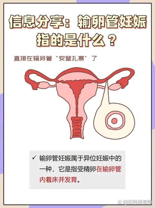 输卵管偏长是为什么_1