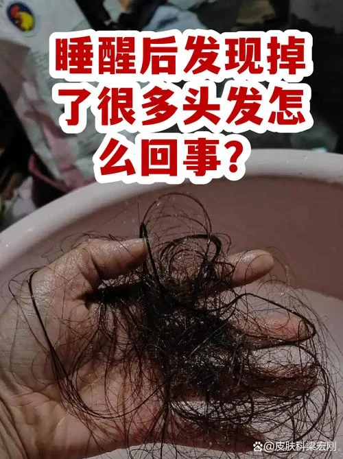 梦见自己脱了好多头发-梦见大量脱发