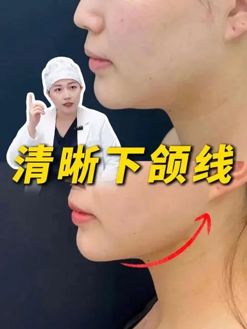 下巴分两半叫什么下巴_2