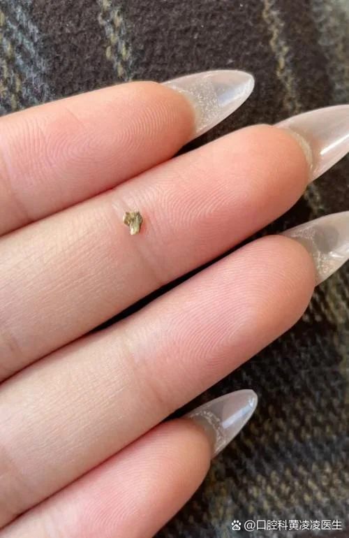 梦见大石牙掉了一小块_1