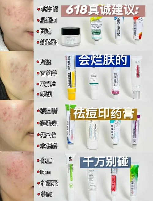 痘痘贴哪个牌子好用吗-痘痘贴推荐好用牌子