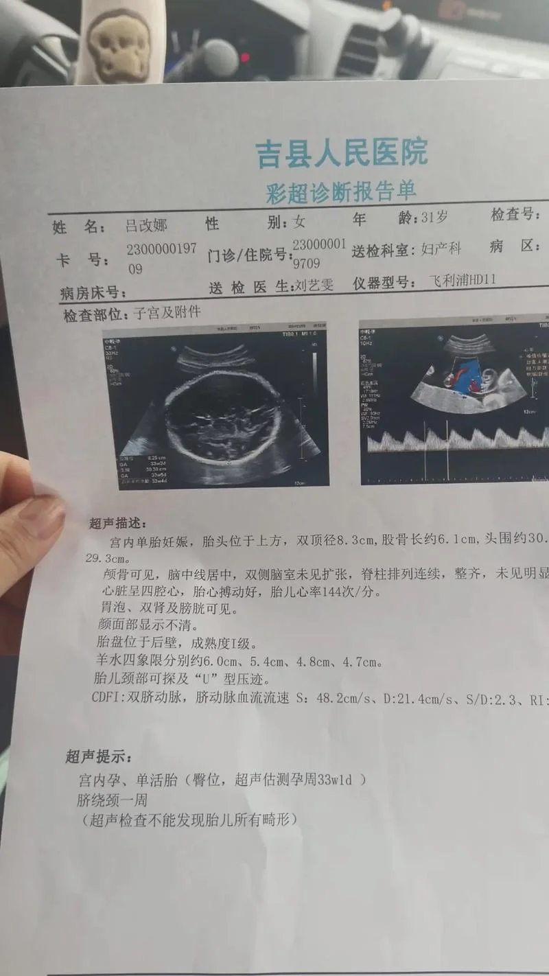 33周偏小两周怎么办_1