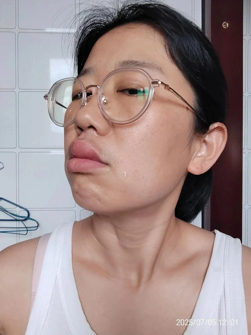梦见马蜂蛰自己的脸_2