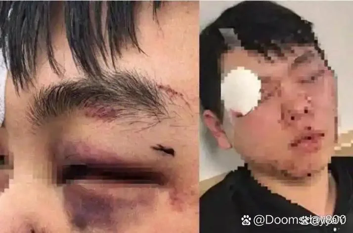 中国留学生林俊遇害_2