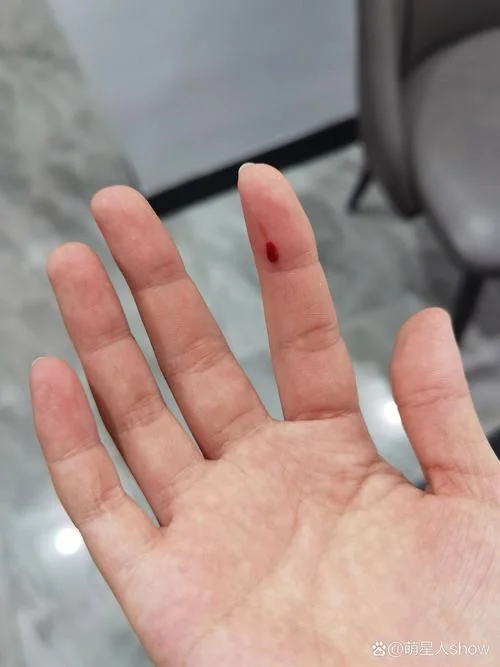 梦到被小狗咬到手腕_2