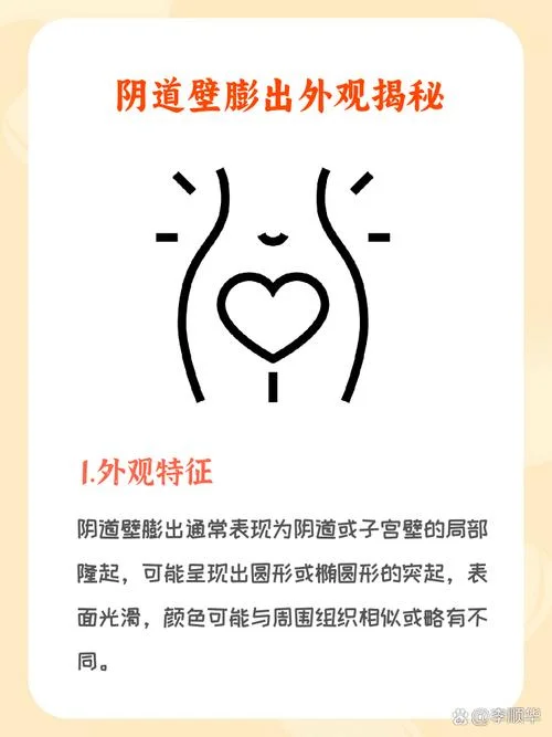 阴壁膨出自己能好吗_2