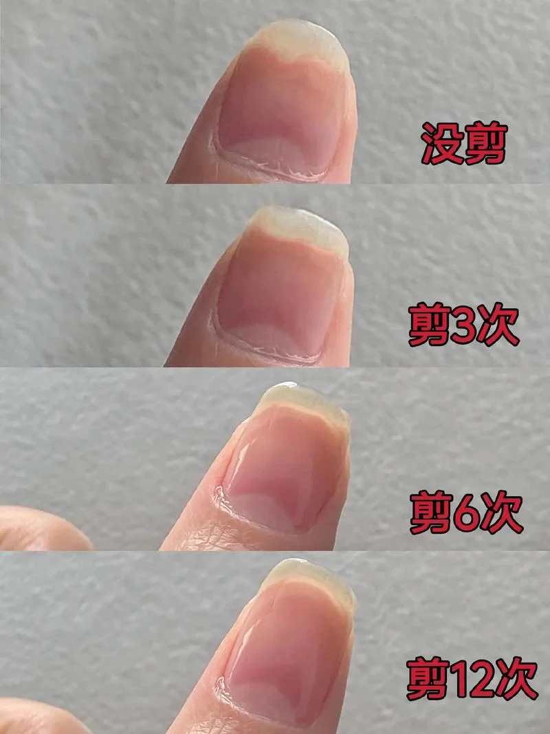 指甲刀变钝了怎么办-指甲刀变钝需更换新刀