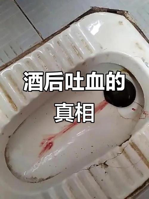 梦见自己吐了好多血_1