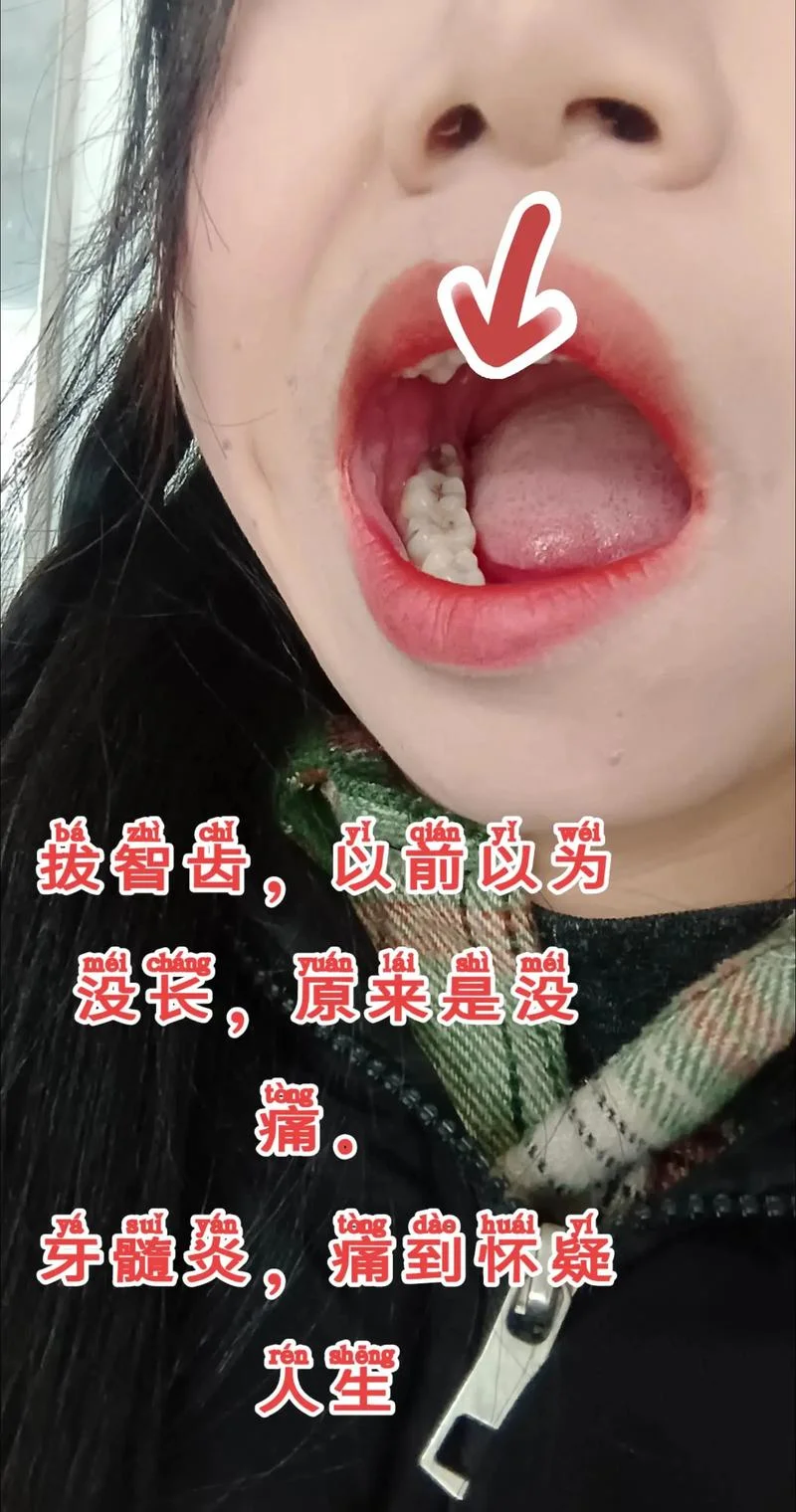 梦见牙疼拔牙-梦见拔牙牙疼
