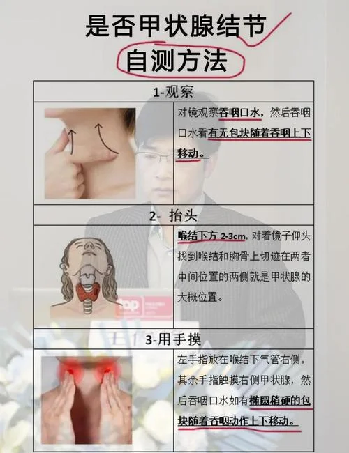 如何查甲状腺_1
