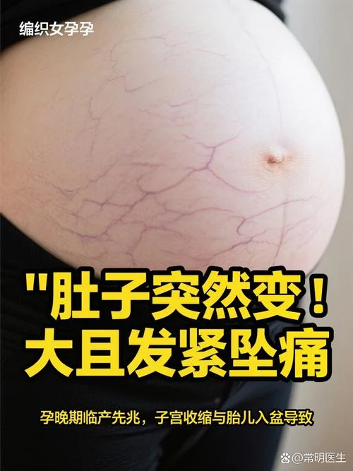 梦见自己怀孕大肚子是啥预兆_2
